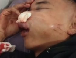 Sadis! Oknum Polisi di Ruteng Diduga Aniaya Warga Hingga Babak Belur